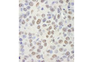 Immunohistochemistry (IHC) image for anti-KH Domain Containing, RNA Binding, Signal Transduction Associated 1 (KHDRBS1) (AA 1-50) antibody (ABIN7448786)