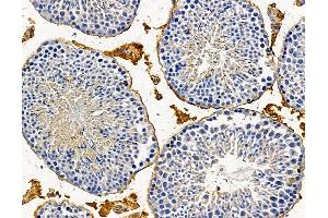 anti-Ectonucleoside Triphosphate diphosphohydrolase 8 (ENTPD8) antibody