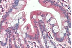 Human, Small intestine: Formalin-Fixed Paraffin-Embedded (FFPE) (TXNDC11 anticorps  (AA 114-126))