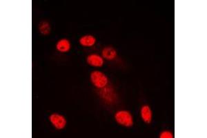 Immunofluorescent analysis of SYNE3 staining in HepG2 cells. (Nesprin3 anticorps  (Center))
