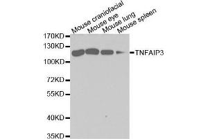 Western blot analysis of extracts of various cell lines, using TNFAIP3 antibody. (TNFAIP3 anticorps  (AA 1-190))