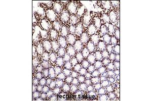 VIME Antibody (ABIN652639 and ABIN2842429) immunohistochemistry analysis in formalin fixed and paraffin embedded human rectum tissue followed by peroxidase conjugation of the secondary antibody and DAB staining. (Vimentin anticorps)