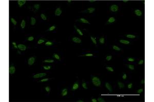 Immunofluorescence of monoclonal antibody to PROX1 on HeLa cell. (PROX1 anticorps  (AA 638-737))