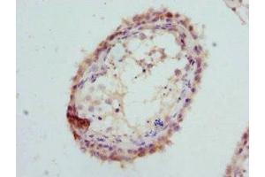 Immunohistochemistry of paraffin-embedded human testis tissue using ABIN7154163 at dilution of 1:100