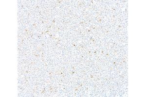 Immunohistochemistry (IHC) image for anti-Tumor Necrosis Factor Receptor Superfamily, Member 9 (TNFRSF9) (AA 24-189) antibody (ABIN7455143)