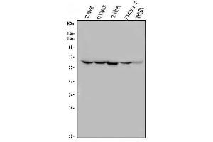Western blot analysis of ME2 using anti-ME2 antibody (ABIN7600967). (NAD-ME anticorps  (AA 26-584))