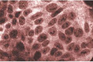 Immunofluorescent staining of HCT-8 cells. (Glucocorticoid Receptor anticorps  (AA 176-289))