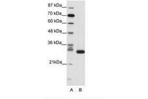 Image no. 1 for anti-Cyclin-Dependent Kinase 5 (CDK5) (N-Term) antibody (ABIN202178) (CDK5 anticorps  (N-Term))