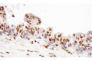 Immunohistochemistry (IHC) image for anti-Replication Protein A2, 32kDa (RPA2) (C-Term) antibody (ABIN7449012) (RPA2 anticorps  (C-Term))