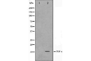 Western blot analysis on COS7 cell lysate using TGF alpha Antibody,The lane on the left is treated with the antigen-specific peptide.