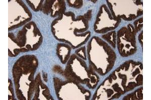 anti-Prostate Specific Antigen (PSA) antibody