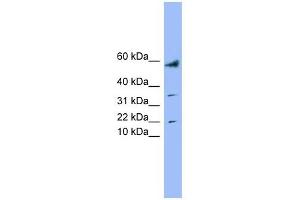 LYRM1 antibody used at 1 ug/ml to detect target protein. (LYRM1 anticorps  (Middle Region))