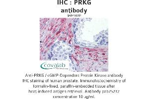 Image no. 2 for anti-PRKG antibody (ABIN1738352) (PRKG anticorps)
