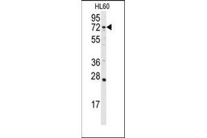 Image no. 1 for anti-Diacylglycerol Kinase, alpha 80kDa (DGKA) (C-Term) antibody (ABIN360612) (DGKA anticorps  (C-Term))
