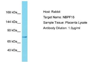 Host: Rabbit Target Name: NBPF15 Sample Tissue: Human Placenta Antibody Dilution: 1ug/ml (NBPF15 anticorps  (N-Term))