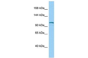Host:  Rabbit  Target Name:  Dsg2  Sample Type:  Mouse Testis lysates  Antibody Dilution:  1. (Desmoglein 2 anticorps  (Middle Region))