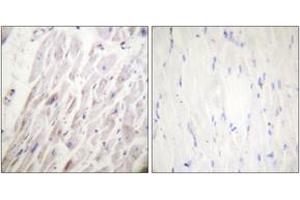 Immunohistochemistry analysis of paraffin-embedded human heart, using Dematin (Phospho-Ser403) Antibody.
