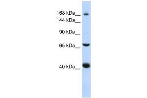 ABCC9 antibody used at 1 ug/ml to detect target protein.
