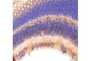 IHC analysis of Frmpd4 using anti-Frmpd4 antibody (ABIN7825375).