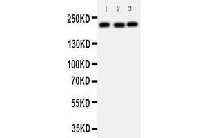 Anti-53BP1 antibody, Western blotting Lane 1: 293T Cell Lysate Lane 2: U20S Cell Lysate Lane 3: HEPA Cell Lysate