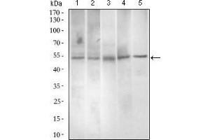 Western blot analysis using PAX3 mouse mAb against A549 (1), A431 (2), Jurkat (3), Rat spleen (4) and Mouse liver (5) cell lysate. (Paired Box 3 anticorps  (AA 142-203))