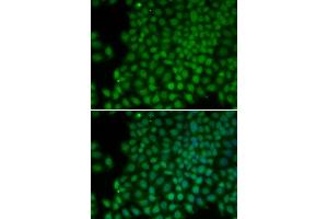 Immunofluorescence analysis of HeLa cells using POLR1C antibody. (POLR1C anticorps)