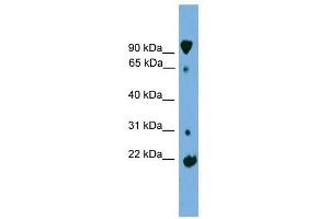 KLHL2 antibody used at 1 ug/ml to detect target protein. (KLHL2 anticorps)