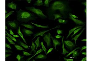 Immunofluorescence of monoclonal antibody to MAPK8 on HeLa cell.