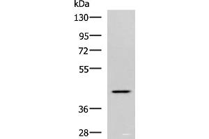 Western blot analysis of Hela cell lysate using SYT2 Polyclonal Antibody at dilution of 1:800 (SYT2 anticorps)
