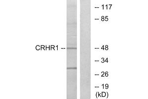 Western blot analysis of extracts from HT-29 cells, using CRHR1 antibody. (CRHR1 anticorps  (Internal Region))