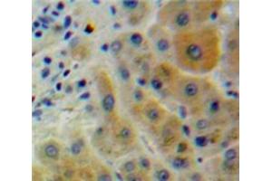 IHC-P analysis of Liver tissue, with DAB staining. (CD2AP anticorps  (AA 149-429))