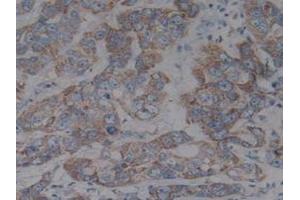 Detection of IkBb in Human Liver Tissue using Polyclonal Antibody to Inhibitory Subunit Of NF Kappa B Beta (IkBb)