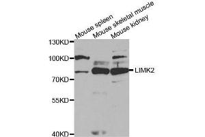 Western blot analysis of extracts of various cell lines, using LIMK2 antibody. (LIMK2 anticorps  (AA 1-240))