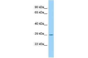 Host: Rabbit Target Name: CCDC134 Sample Type: Fetal Kidney lysates Antibody Dilution: 1. (CCDC134 anticorps  (C-Term))