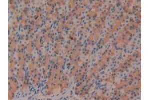 DAB staining on IHC-P; Samples: Rat Stomach Tissue (Fibrillin 1 anticorps  (AA 1475-1638))