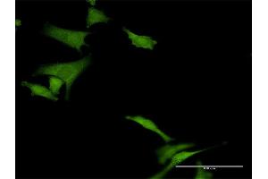 Immunofluorescence of purified MaxPab antibody to HABP4 on HeLa cell. (HABP4 anticorps  (AA 1-308))