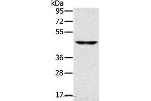 Western blot analysis of Human fetal brain tissue, using SLC16A8 Polyclonal Antibody at dilution of 1:200 (MCT3 anticorps)