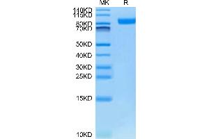 Cynomolgus Neuropilin-1 on Tris-Bis PAGE under reduced condition. (Neuropilin 1 Protein (NRP1) (AA 22-644) (His tag))