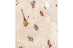 (ABIN652381 and ABIN2841827) staining TrkA in human brain tissue sections by Immunohistochemistry (IHC-P - paraformaldehyde-fixed, paraffin-embedded sections). (TrkA-pY791 (AA 769-796) anticorps)