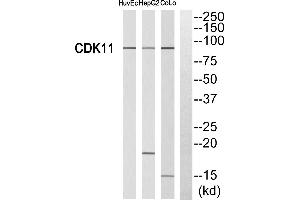 Western blot analysis of extracts from HUVEC cells, HepG2 cells and CoLo cells, using CDK11 antibody.
