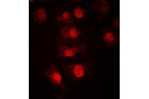 Immunofluorescent analysis of TCFL4 staining in LOVO cells.