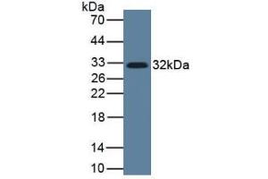 Western blot analysis of Human Lung Tissue, using IL33 antibody and HRP-conjugated Rabbit Anti-Mouse antibody ( (IL-33 anticorps  (AA 112-270))