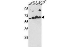 Image no. 1 for anti-Calreticulin (CALR) (Middle Region) antibody (ABIN452803) (Calreticulin anticorps  (Middle Region))