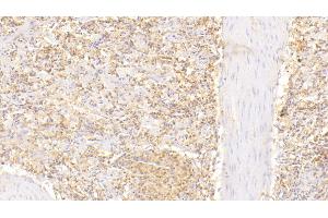 Detection of MSN in Human Spleen Tissue using Polyclonal Antibody to Moesin (MSN)