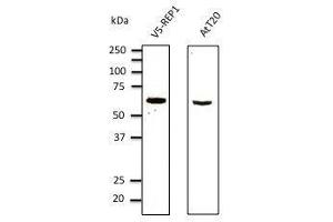Anti-myc tag Ab at 1/1,000 dilution, 293 cells transfected With myc-mCherry (red fluorescent protein), rabbit polyclonal to goat lµg (HRP) at 1/10,000 dilution,