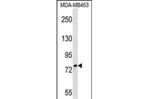 PNPT1 Antibody (Center) (ABIN1538242 and ABIN2849157) western blot analysis in MDA-M cell line lysates (35 μg/lane). (PNPT1 anticorps  (AA 284-311))