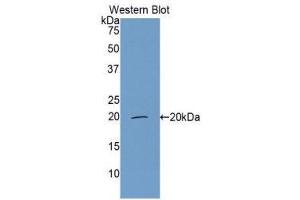 Western Blotting (WB) image for anti-Complement Factor P (CFP) (AA 315-469) antibody (ABIN3207872) (CFP anticorps  (AA 315-469))
