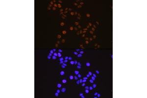 Immunofluorescence analysis of HeLa cells using RXRα Rabbit mAb (ABIN7269948) at dilution of 1:100 (40x lens).