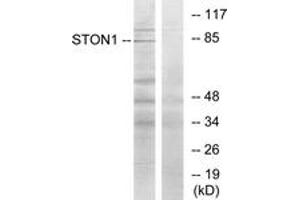 Western blot analysis of extracts from K562 cells, using STON1 Antibody. (STON1 anticorps  (AA 686-735))