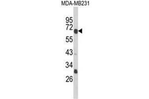 Western blot analysis of GIPR Antibody (Center) in MDA-MB231 cell line lysates (35ug/lane). (GIPR anticorps  (Middle Region))